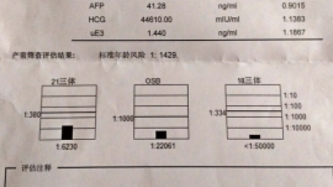 唐氏综合症筛查.doc