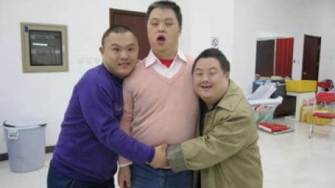 唐氏综合征是什么疾病