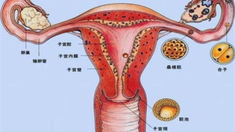 #子宫腺肌症子宫10多公分大#怎么办？