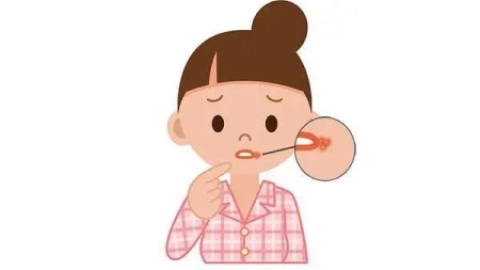 嘴巴经常起泡竟是“单纯疱疹”病毒感染！还会互相传染