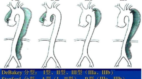 马凡氏综合症如何确诊？