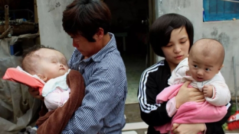 女子生龙凤双胞胎, 8个月后姐姐比弟弟头大两倍, 被人当怪物