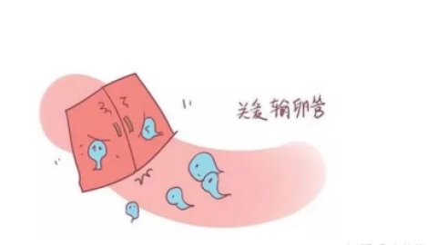 哪些不孕女性需要做输卵管造影？输卵管造影后多久可以做试管婴儿？