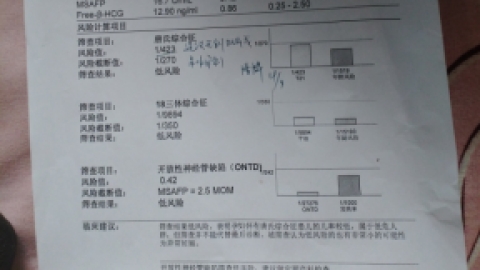 唐氏综合症是什么病 唐氏综合症的症状