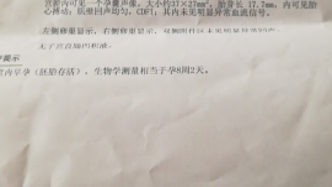 子宫腺肌症综述ppt课件_理化生_高中教育_教育专区