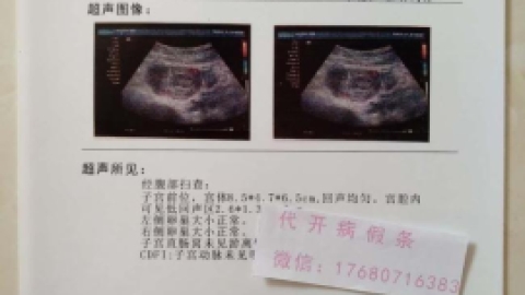 唐氏综合症产前筛查方法