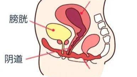 产后恶露是怎么回事？