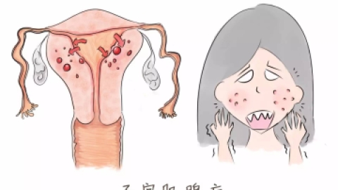 子宫腺肌症对身体有哪些方面的伤害？