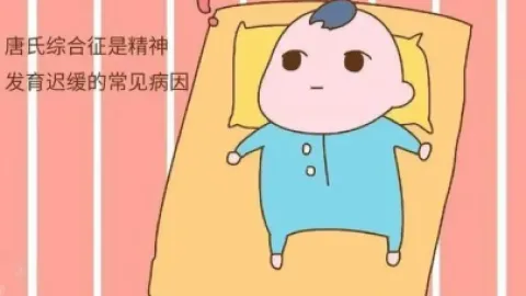 唐氏综合症科普_基础医学_医药卫生_专业资料