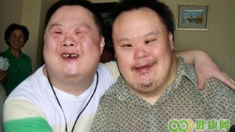 新的研究发现，在患有唐氏综合症的儿童中，孕龄和多动症之间存在联系