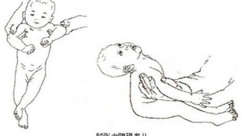 新生儿体检时间及项目介绍