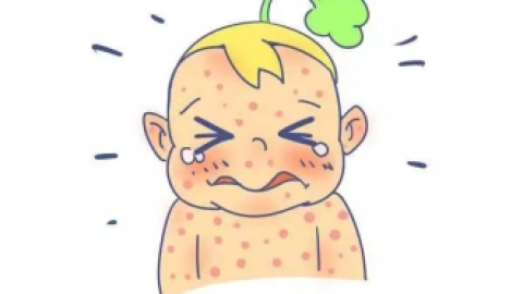 【幼儿急疹】--宝宝发烧先别急，看看这个~~