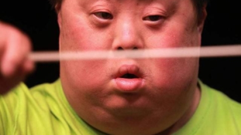 唐氏综合症形成原因及身体需注意事项！